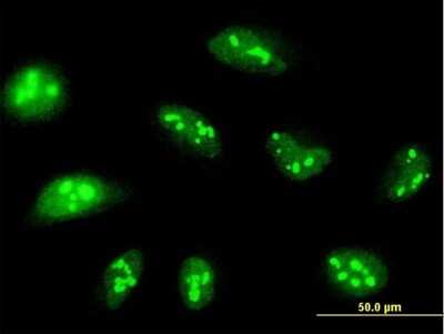 Immunocytochemistry/ Immunofluorescence: NOP14 Antibody [H00008602-B01P]