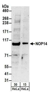 Western Blot: NOP14 Antibody [NBP2-22227]