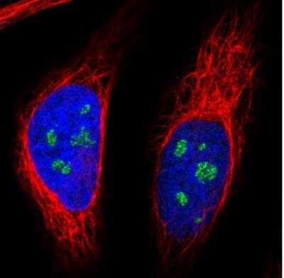 Immunocytochemistry/ Immunofluorescence: NOP56 Antibody (CL2603) [NBP2-36778]