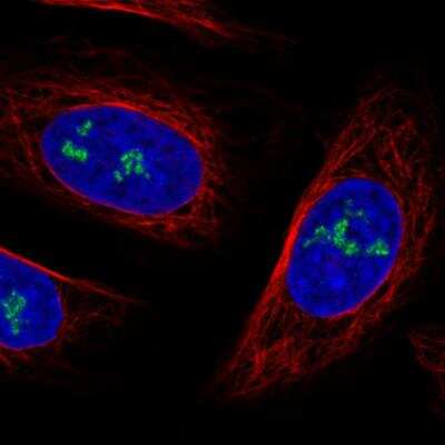 Immunocytochemistry/ Immunofluorescence: NOP56 Antibody (CL2603) [NBP2-36778]