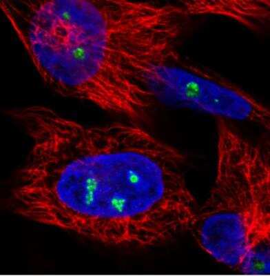 Immunocytochemistry/ Immunofluorescence: NOP56 Antibody (CL2603) [NBP2-36778]