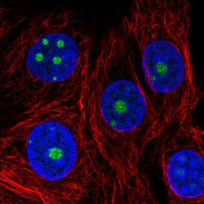 Immunocytochemistry/ Immunofluorescence: NOP56 Antibody (CL2603) [NBP2-36778]