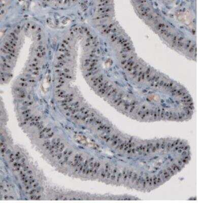 Immunohistochemistry: NOP56 Antibody (CL2603) [NBP2-36778]