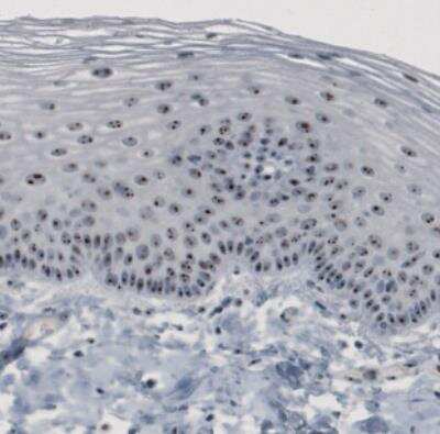 Immunohistochemistry: NOP56 Antibody (CL2603) [NBP2-36778]