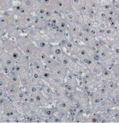 Immunohistochemistry: NOP56 Antibody (CL2603) [NBP2-36778]