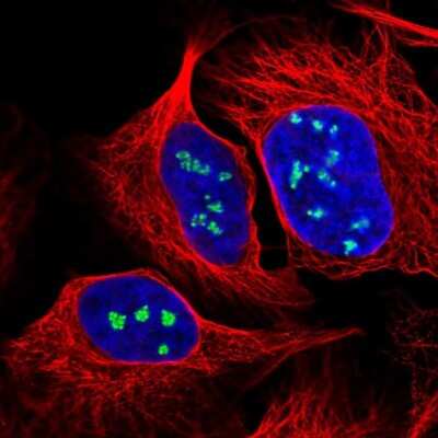 Immunocytochemistry/ Immunofluorescence: NOP56 Antibody [NBP2-13666]