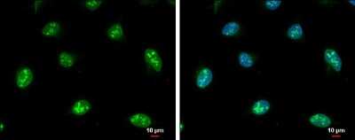 Immunocytochemistry/ Immunofluorescence: NOP56 Antibody [NBP3-12977]