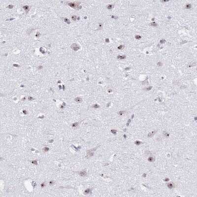 Immunohistochemistry-Paraffin: NOP56 Antibody [NBP2-13666]