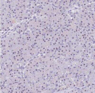 Immunohistochemistry-Paraffin: NOP56 Antibody [NBP2-13666]