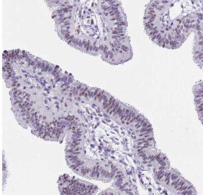 Immunohistochemistry-Paraffin: NOP56 Antibody [NBP2-13666]