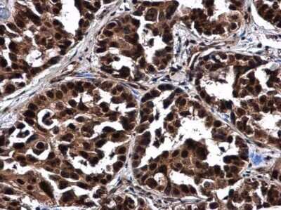 Immunohistochemistry-Paraffin: NOP56 Antibody [NBP3-12977]