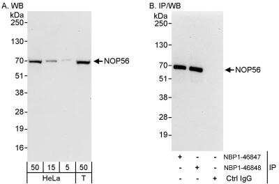 Western Blot: NOP56 Antibody [NBP1-46848]
