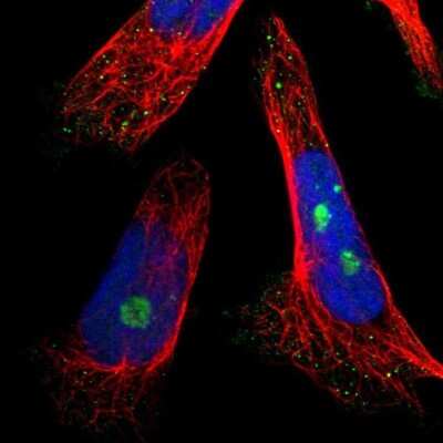Immunocytochemistry/ Immunofluorescence: NOP58 Antibody [NBP1-81680]