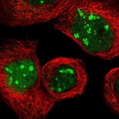 Immunocytochemistry/ Immunofluorescence: NOP58 Antibody [NBP1-81681]