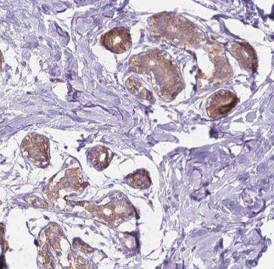 Immunohistochemistry-Paraffin: NOS1AP Antibody [NBP2-38151]