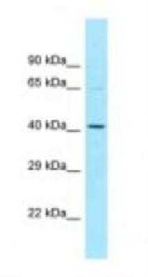Western Blot: NOS1AP Antibody [NBP1-98487]