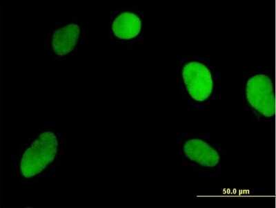 Immunocytochemistry/ Immunofluorescence: NOSIP Antibody [H00051070-B01P]