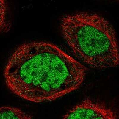 Immunocytochemistry/ Immunofluorescence: NOSIP Antibody [NBP1-85661]