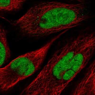 Immunocytochemistry/ Immunofluorescence: NOSIP Antibody [NBP2-55693]