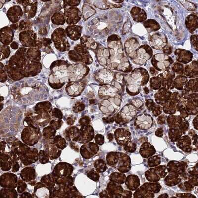 Immunohistochemistry-Paraffin: NOSTRIN Antibody [NBP2-13667]