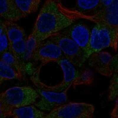 Immunocytochemistry/ Immunofluorescence: NOTUM Antibody [NBP3-17285]