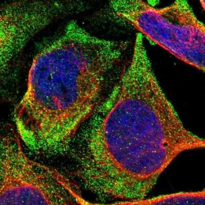 Immunocytochemistry/ Immunofluorescence: NOV/CCN3 Antibody [NBP1-88154]