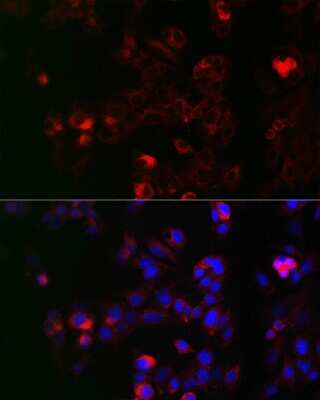 Immunocytochemistry/ Immunofluorescence: NOX1 Antibody - Azide and BSA Free [NBP2-93967]