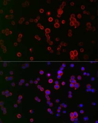 Immunocytochemistry/ Immunofluorescence: NOX1 Antibody - Azide and BSA Free [NBP2-93967]