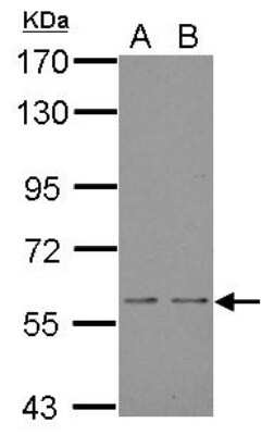 Western Blot: NOX1 Antibody [NBP1-31546]