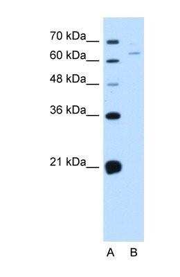 Western Blot: NOX1 Antibody [NBP1-69573]