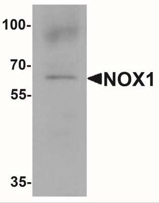 Western Blot: NOX1 AntibodyBSA Free [NBP2-41290]