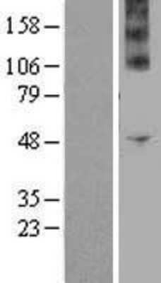 Western Blot: Nox4 Overexpression Lysate [NBP2-04362]