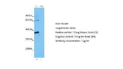 Western Blot: NOX5 Antibody [NBP2-84191]