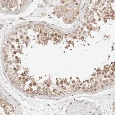 Immunohistochemistry-Paraffin: NPAS2 Antibody [NBP1-88612]
