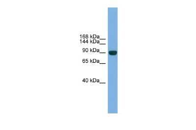 Western Blot: NPAS2 Antibody [NBP3-10408]