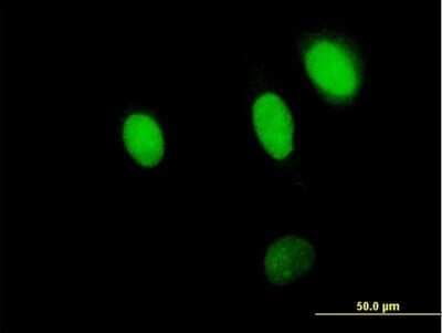 Immunocytochemistry/ Immunofluorescence: NPLOC4 Antibody [H00055666-B01P]
