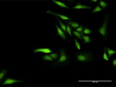 Immunocytochemistry/ Immunofluorescence: NPLOC4 Antibody [H00055666-D01P]