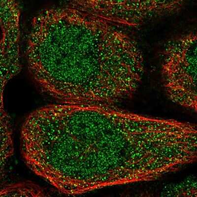 Immunocytochemistry/ Immunofluorescence: NPLOC4 Antibody [NBP1-82165]