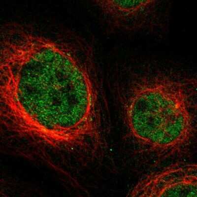 Immunocytochemistry/ Immunofluorescence: NPLOC4 Antibody [NBP1-82166]