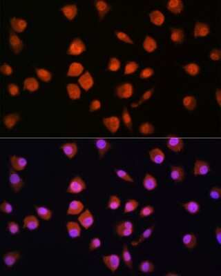 Immunocytochemistry/ Immunofluorescence: NPLOC4 Antibody - BSA Free [NBP2-94655]