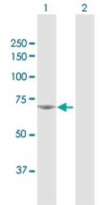 Western Blot: NPLOC4 Antibody [H00055666-D01P]