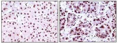 Immunohistochemistry-Paraffin: NPM1 Antibody (7H10B9) - BSA Free [NBP1-47354]