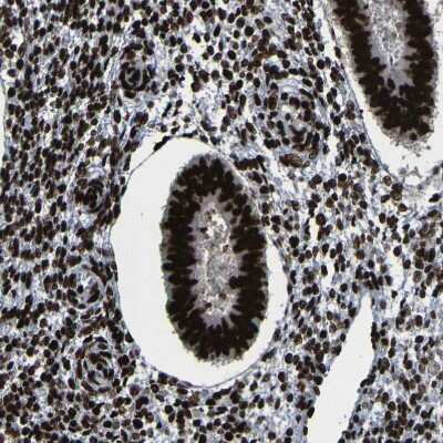 Immunohistochemistry-Paraffin: NPM1 Antibody [NBP1-90047]