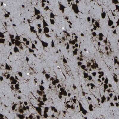 Immunohistochemistry-Paraffin: NPM1 Antibody [NBP1-90047]