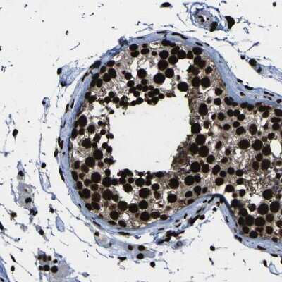 Immunohistochemistry-Paraffin: NPM1 Antibody [NBP1-90047]