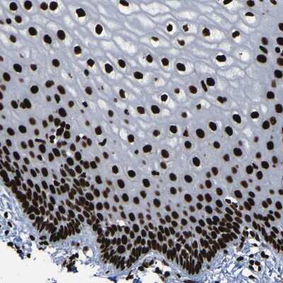 Immunohistochemistry-Paraffin: NPM1 Antibody [NBP1-90047]