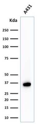 Western Blot: NPM1 Antibody (NPM1/1902)Azide and BSA Free [NBP2-79874]