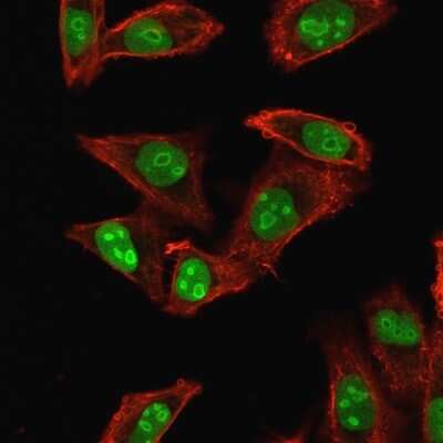 Immunocytochemistry/ Immunofluorescence: NPM1 Antibody (NPM1/1902) [NBP2-79739]