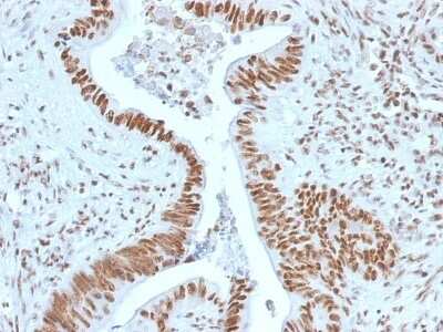 Immunohistochemistry-Paraffin: NPM1 Antibody (NPM1/1902) [NBP2-79739]