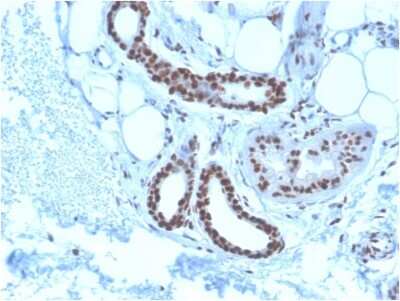 Immunohistochemistry-Paraffin: NPM1 Antibody (NPM1/3285) [NBP3-07448]
